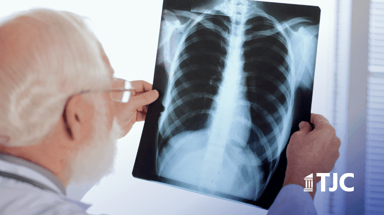 Mesothelioma Lawsuit